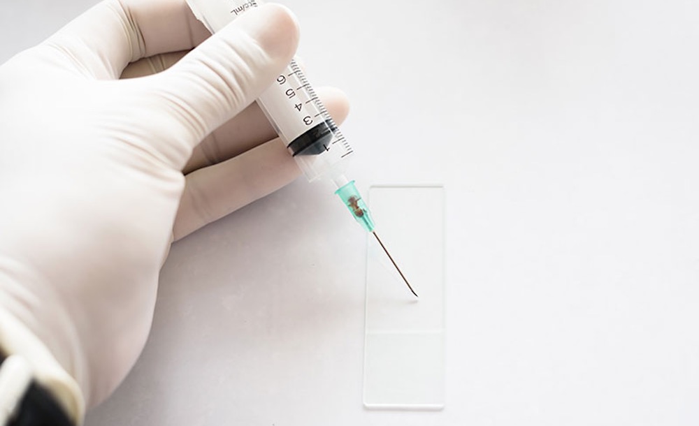 Sitolojik İncelemeler